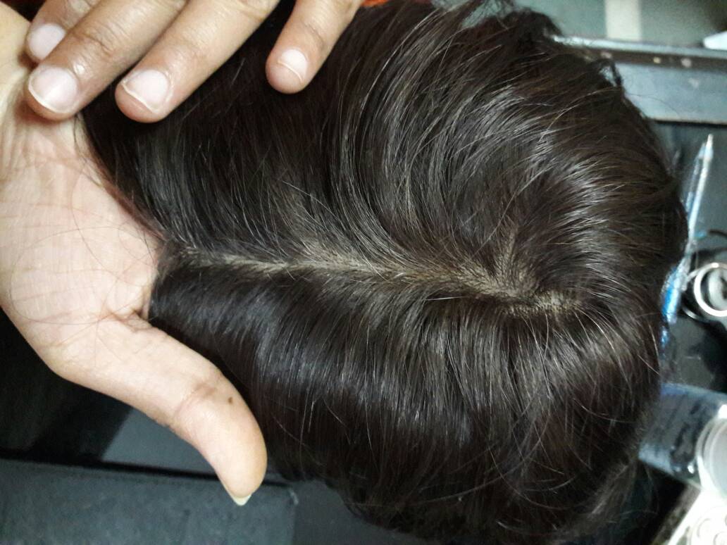 Features of the Australian Mirage hair patch